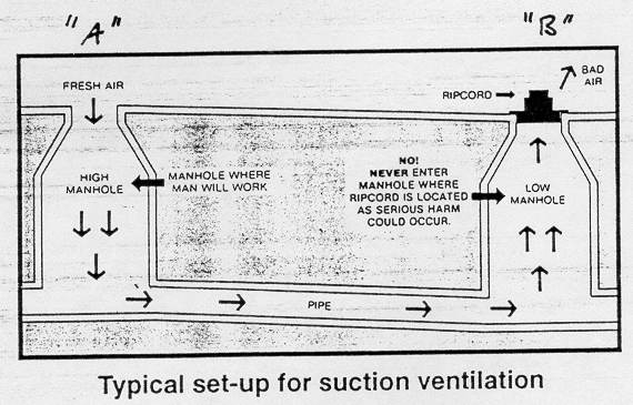 Typical set-up for suction ventilation