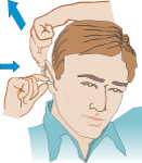 Figure 3:  Hand reaching over the head to pull the ear up and back while inserting the earplug with the other hand.