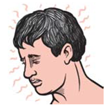 Illustration of a man's head who seems to have a high body temperature