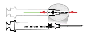 Figure 3. Syringe with Retractable Needles. The used needle retracts into the barrel of the syringe.†