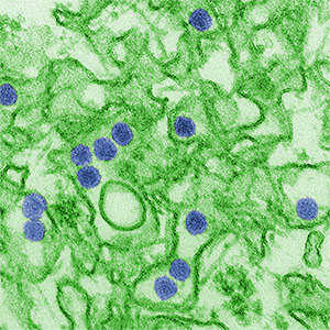 This is a digitally-colorized transmission electron micrograph (TEM) of Zika virus. In 2015, cases of Zika virus infection emerged in the Americas and the Caribbean