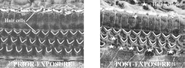 Prior and post exposure.